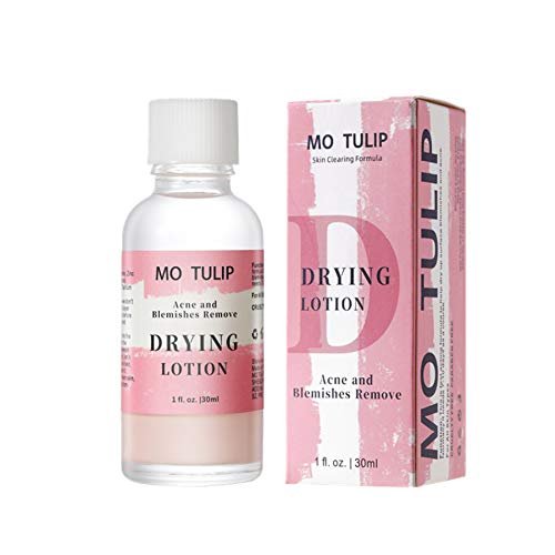 MO TULIP Acne Drying Lotion, Overnight Acne Acid and Acne...
